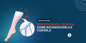 Come Eliminare la Dermatite da Stasi