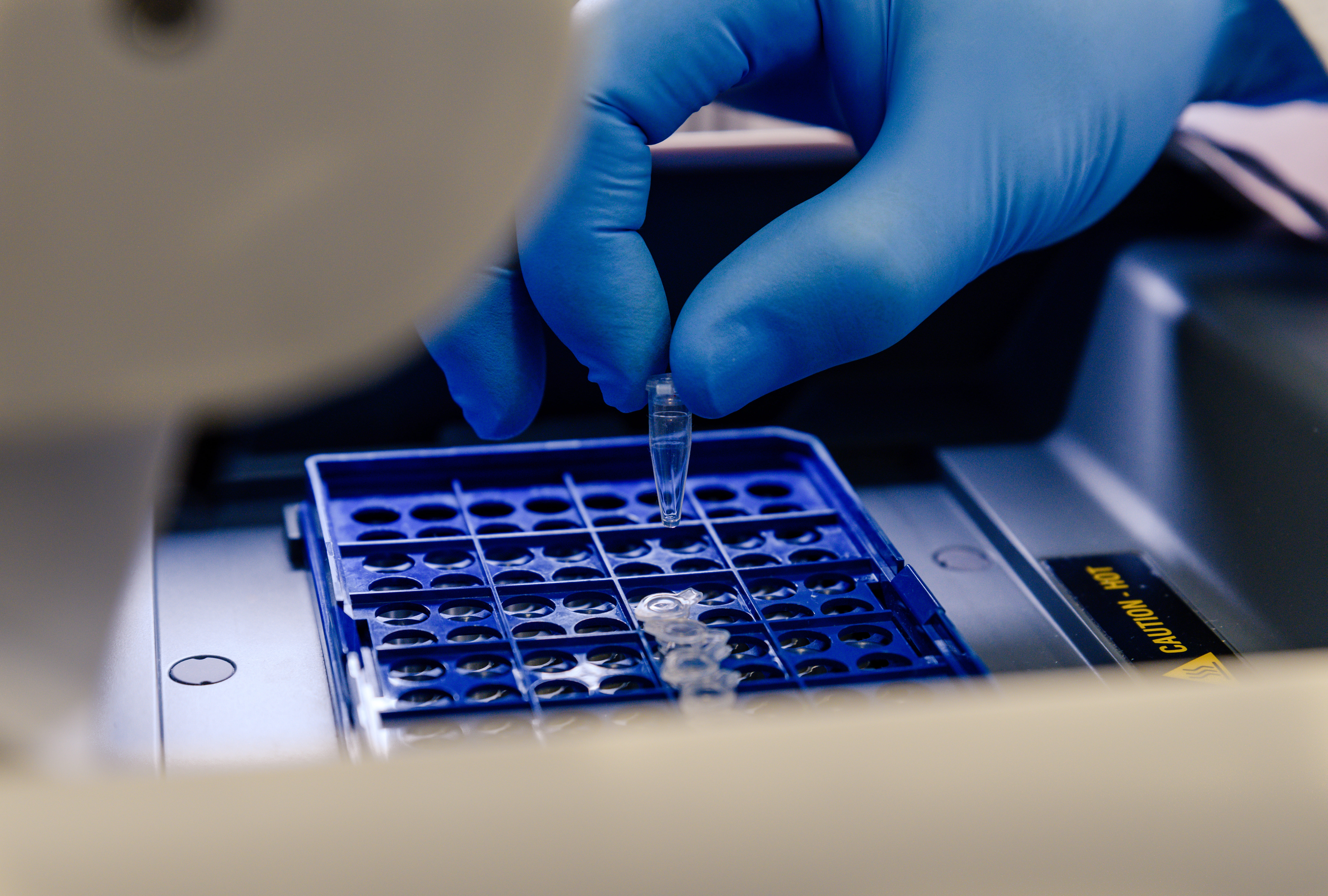 CRISPR: il primo neonato geneticamente modificato. Svolta nella medicina genetica 1 Ricercatore in laboratorio maneggia campione genetico con guanti sterili, durante preparazione per terapia CRISPR e editing genetico su malattie rare