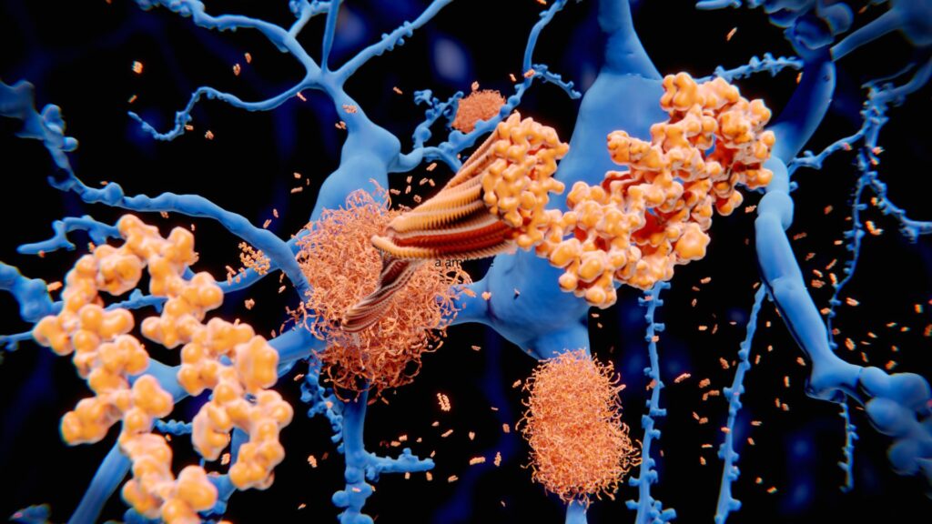 Nuove cure per Alzheimer: complessità patologica, nuovi farmaci e prospettive future 2 Beta amiloide; responsabile della formazione delle placche amiloidi